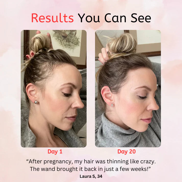 Professional High-Frequency Wand for Acne Treatment & Skin Rejuvenation