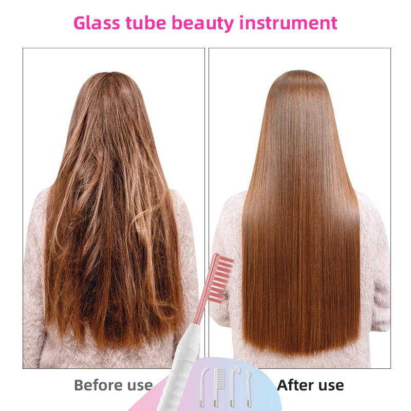 Professional High-Frequency Wand for Acne Treatment & Skin Rejuvenation