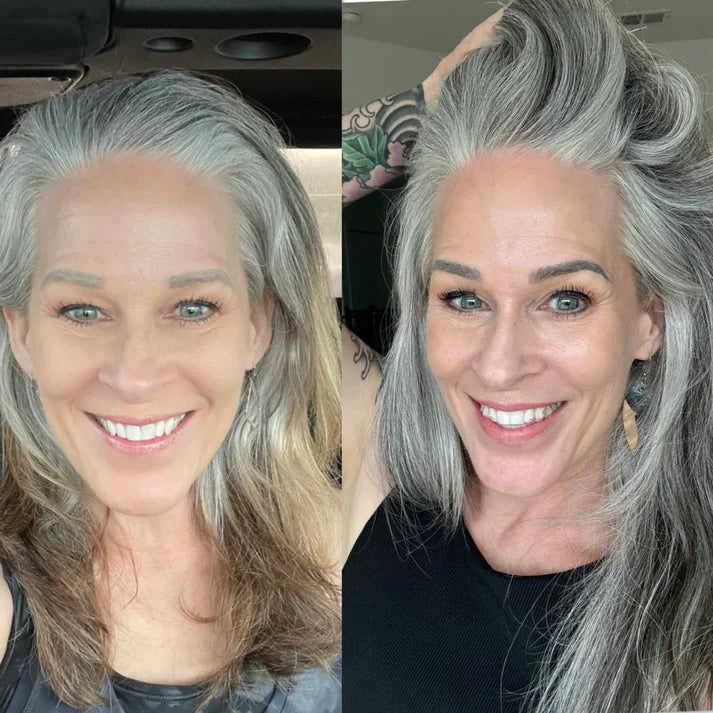 Using high-frequency wand on facial acne spots