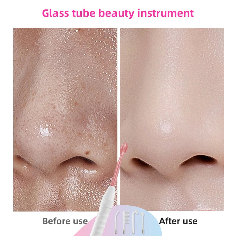 Professional High-Frequency Wand for Acne Treatment & Skin Rejuvenation