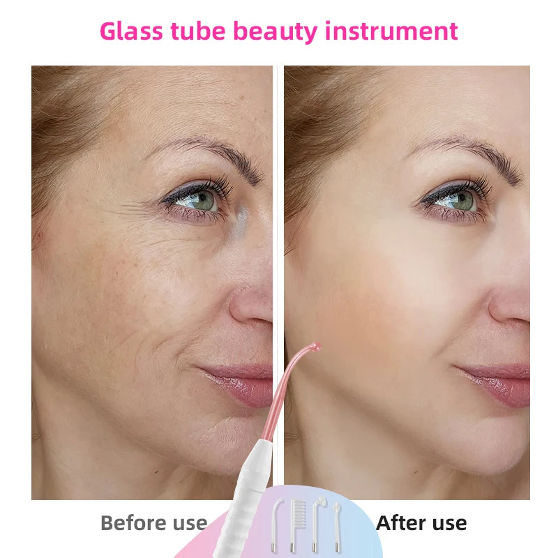 Professional High-Frequency Wand for Acne Treatment & Skin Rejuvenation