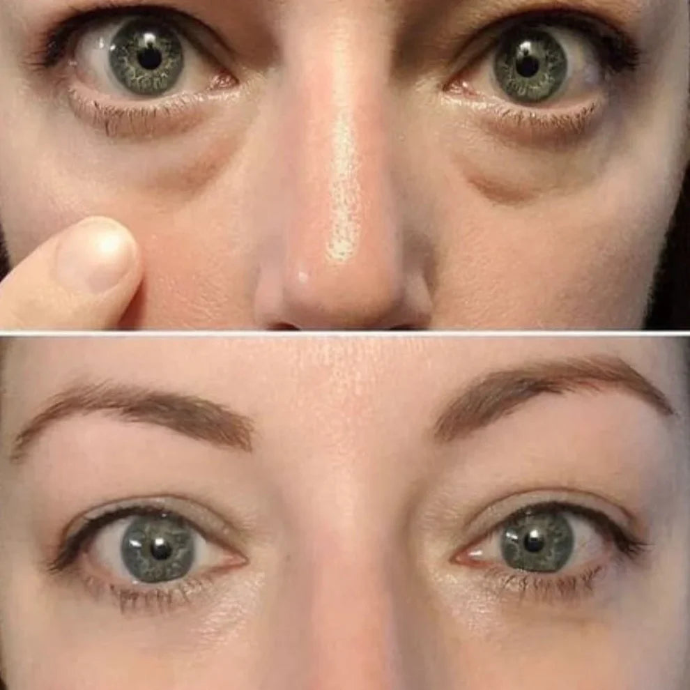 Professional EMS Micro-Current EMS Microcurrent Eye Massager - Anti-Aging Beauty Device