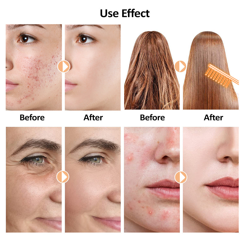 Professional high-frequency wand with power cord