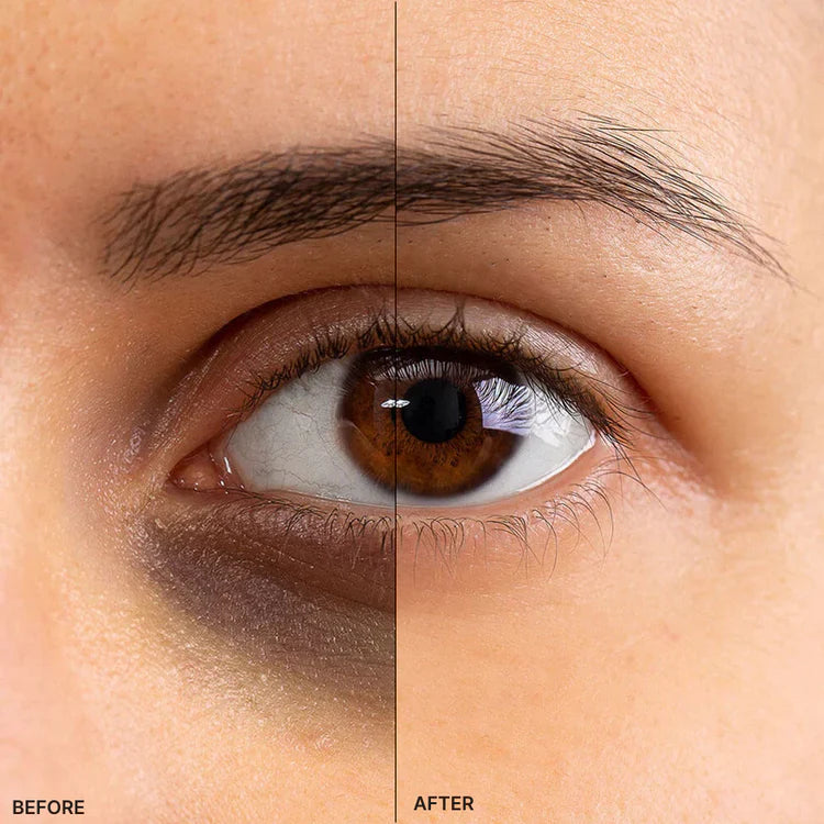 Professional EMS Micro-Current EMS Microcurrent Eye Massager - Anti-Aging Beauty Device