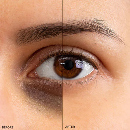 Professional EMS Micro-Current EMS Microcurrent Eye Massager - Anti-Aging Beauty Device