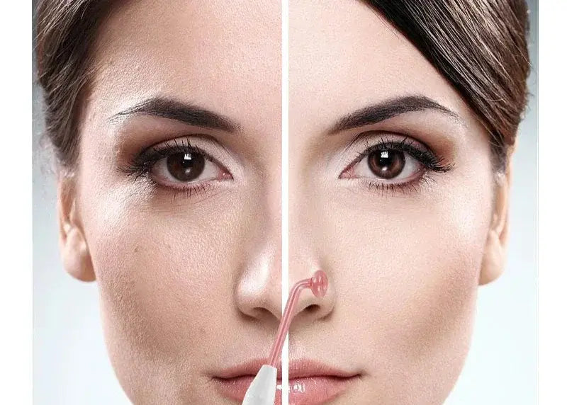 Before and after comparison of a woman using a skincare device on her nose.