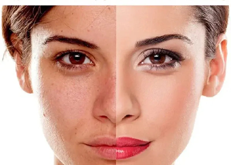 Before and after comparison of a woman's face with cosmetic changes.